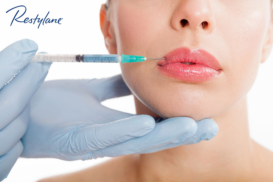 Restylane Lip Injections